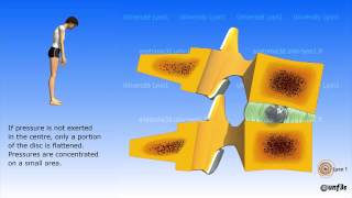 The intervertebral disc [upl. by Eldwon]