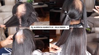 ALOPECIA NO PROBLEM HOW I COVERED ALOPECIA WITH NATURAL HAIR SILK PRESS [upl. by Navert]