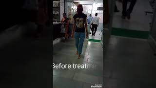 Ayurvedic treatment of transverse myelitis [upl. by Aerdnek]