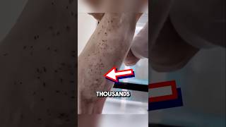 Extremely satisfying bug removal 😱 shorts oddlysatisfying [upl. by Eceined]