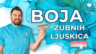 Kako odabrati boju zubnih ljuskica i krunica  Hollywood smile  Dental Centar 4Smile [upl. by Adella]