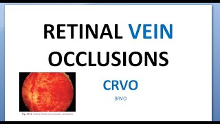 Ophthalmology CRVO Central Retinal Vein Occlusion Splashed tomato Thunder Ischemic RAPD glaucoma [upl. by Roydd]