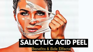 Flawless Complexion or Skin Sensitivity Understanding the Effects of Salicylic Acid Peels [upl. by Hirst]