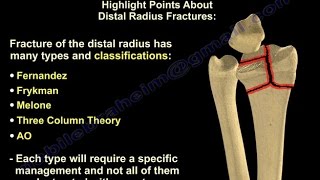 Distal Radius Fractures  Everything You Need To Know  Dr Nabil Ebraheim [upl. by Atalante]