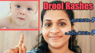 Drool Rash in Babies  Remedies and Cure [upl. by Xilef941]