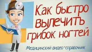 Как лечить грибок ногтей народными средствами [upl. by Whitaker101]