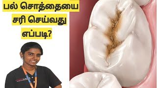 பல் சொத்தைக்கான காரணங்களும் தீர்வுகளும் Reasons treatment for tooth cavity in Tamil [upl. by Naelopan]