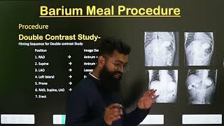 Barium Meal Procedure  Part2  In Hindi  Radiology Procedure [upl. by Alamat]