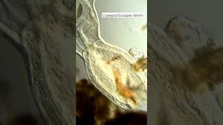 Copepod Escapes Worm Under Microscope microbiology [upl. by Jepum]