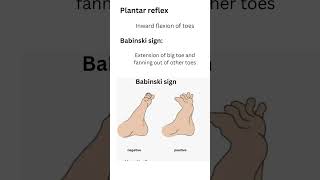 Babinski signUpper motor neuron lesionplantar reflex [upl. by Elfrida283]