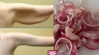 Lose Arm Fat in 3 days with Onion Water  Get rid of Flabby Arms amp tone Sagging arms [upl. by Mauchi]