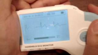 ECG Monitor  portable handheld [upl. by Sabella775]