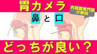 【胃カメラ】鼻からと口から、どちらがオススメ？内視鏡専門医が解説。 [upl. by Annaeel]