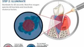 Understanding Photodisinfection [upl. by Annocahs]