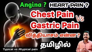 Heart Attack Pain in tamil  cardiac painsymptomsAngina in tamil Chest pain in tamil  Ps tamil [upl. by Godliman798]