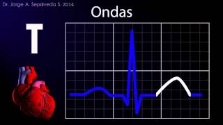 Electrocardiografía Básica Parte 14 [upl. by Carce339]