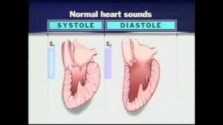 Auscultation of Heart Sounds Part1  Listening to Heart Sounds [upl. by Simmonds]