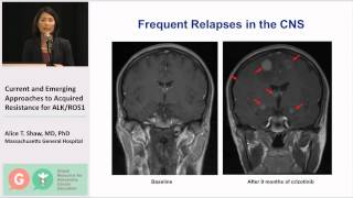 Current amp Emerging Approaches to Acquired Resistance for ALKROS1 [upl. by Pantia291]