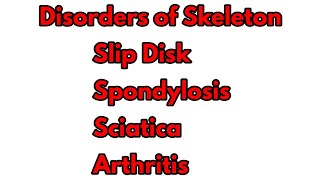 Disorders OF Skeleton Class 12 BioSlip DiscSpondylosisSciaticaArthritisBone Frature [upl. by Nnaylime]