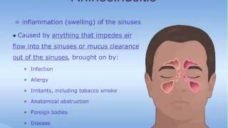 What are the Sinuses [upl. by Jeremie]