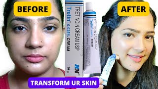 I Used Tretinoin for 1 Year and THIS happened  Tretinoin Update Pm Skin Care Routine with retinA [upl. by Odrarej]