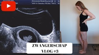 EERSTE ECHO amp MISSELIJK  6 7 amp 8 weken  ZWANGERSCHAP VLOG 3 [upl. by Hartzke]