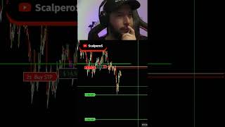 TRADING SCALPING EN SEGUNDOS 🔴EN VIVO🔴💎FUTUROS💎 NASDAQ y SP500💎 [upl. by Heck]