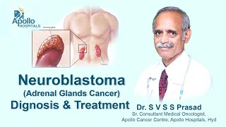 Neuroblastoma  Diagnosis amp Treatment  Dr SVSS Prasad Medical Oncologist  Apollo Hospital [upl. by Marguerite]