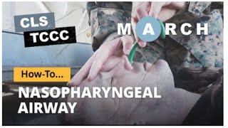 TCCC Nasopharyngeal Airway How to for Combat LifeSavers [upl. by Winser]