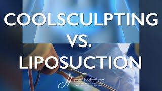 CoolSculpting vs Liposuction and Lipo360 [upl. by Bloom632]