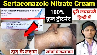 Sertaconazole nitrate cream 2 ww  sertaconazole cream  onabet cream kis kaam aati hai [upl. by Hinda]