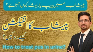 How to treat urine infection  Dr Ammar Shafique [upl. by Forester]