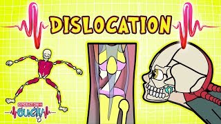 Operation Ouch  Disastrous Dislocations  Skeletal System [upl. by Ylellan]