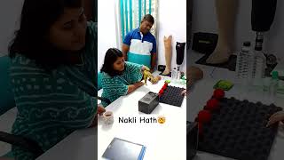 Nakli Hath  Artificial Hand  Motorica  Mechanical Hand  artificiallimb ossur disability [upl. by Negris]