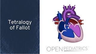 Tetralogy of Fallot by M Mazwi  OPENPediatrics [upl. by Kylah]