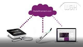 Osstell Beacon  ISQ guides your implant treatments [upl. by Conway]