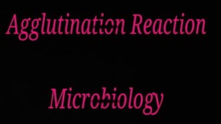 Agglutination reaction in hindi [upl. by Kerr]