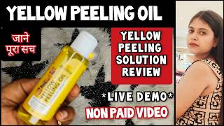 Yellow Peeling Oil Review  Tsuyoi Yellow Peeling Oil  Chemical Peel At Home [upl. by Kutzenco228]