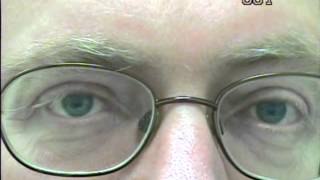 Nystagmus eye movement recording 1 [upl. by Ttezzil]