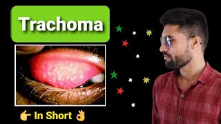 Trachoma lecture opthalmology [upl. by Imiaj24]