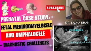 Prenatal Case Study Fetal Meningomyelocele and Omphalocele – Diagnostic Challenges DrSaimakhan [upl. by Jaquelin]