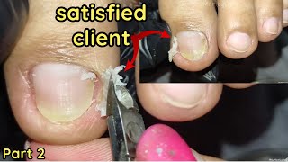 Vlog 1136Dry SkinIngrown Removal PEDICURE 1036 [upl. by Sidran830]