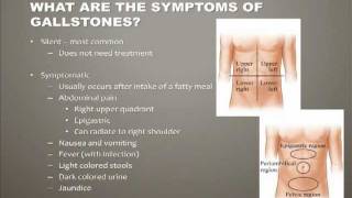 Diseases of the Gallbladder [upl. by Rains]