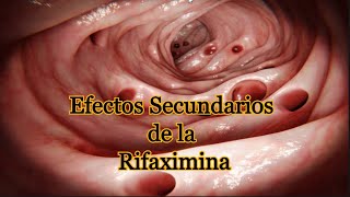 Efectos Secundarios de la Rifaximina [upl. by Ecirpac9]