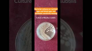 Bacillus subtilis Enterococcus fecalis Desulfovibrio cultures and colonies health microbiology [upl. by Wrdna387]