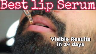 Effective Lip Serum for Dark Lips  No Chemicals  உங்க லிப்ஸ் டார்க்கா இருந்தா இது try பண்ணுங்க [upl. by Noffihc]