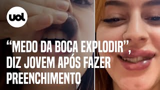 Preenchimento labial gera complicação e viraliza Medo da boca explodir [upl. by Serg858]