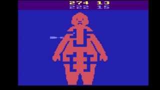 MASH  Atari 2600  Video Games Based on TV Shows Fox 1983 [upl. by Eeltrebor]