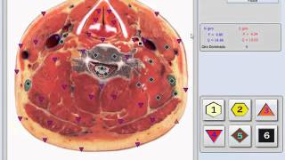 Bioplasm 10D NLS Modelo 2016 [upl. by Sadiras]