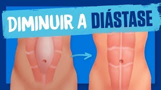 EXERCÍCIO para a DIÁSTASE abdominal Como diminuir a diástase [upl. by Akcinat]